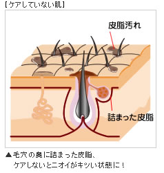 �P�A���Ă��Ȃ���